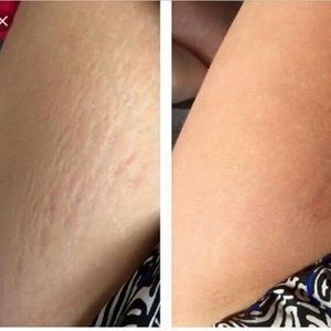 PRE-ORDER ONLY Stretch Mark & Multi-Tasking Cream